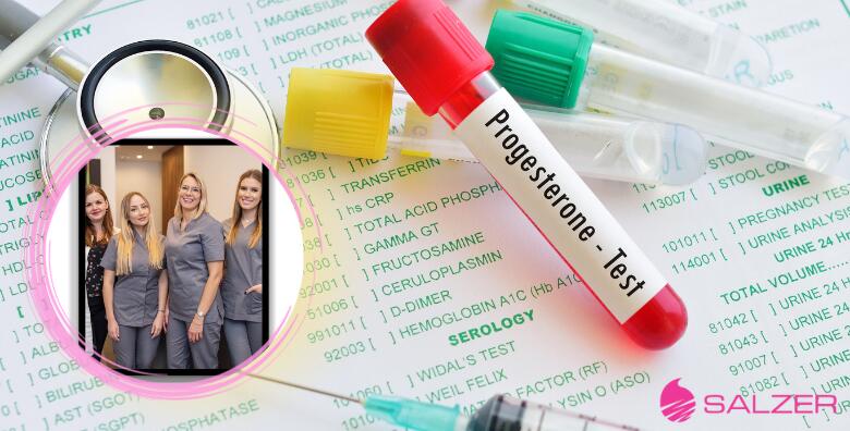 Analiza spolnih hormona za žene