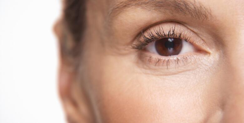 Plasma Pen - inovativnom metodom zategnite opuštenu kožu gornjih <br> kapaka i uklonite znakove starenja uz odlične rezultate bez reza i ožiljaka