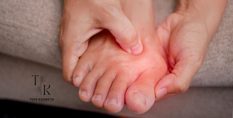 Tretman kurjeg oka - riješite se tvrdog i upaljenog zadebljanja na koži stopala već danas!