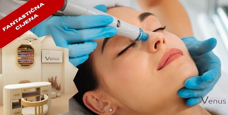JEDINSTVENA "ONE-TIME" PONUDA - osvježite kožu svoga lica HYDRAFACIAL tretmanom u NOVOOTVORENOM Medicinsko estetskom centru Venus by Lucija Šarić u SESVETAMA