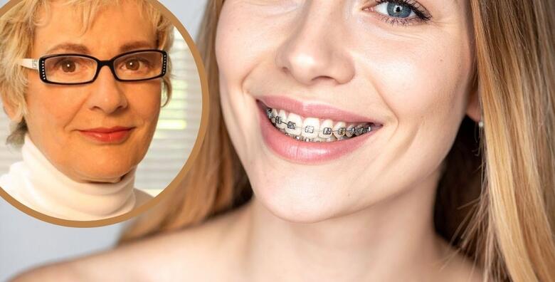 FIKSNI APARATIĆ ZA ZUBE - konvencionalni metalni