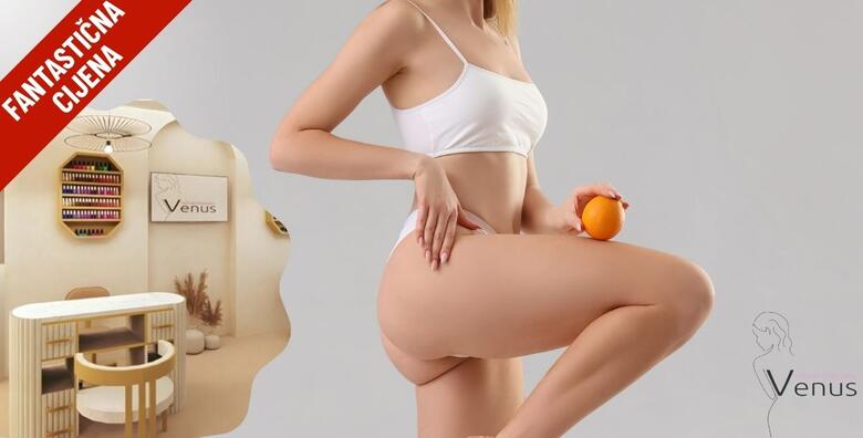 Ekskluzivna ponuda koja se ne ponavlja! Anticelulitni tretmani u NOVOOTVORENOM Medicinsko estetskom centru Venus by Lucija Šarić u SESVETAMA po fantastičnoj cijeni