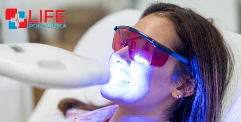 IZBJELJIVANJE ZUBI - izrada udlaga prema individualnim potrebama uz pregled i konzultacije stručnog tima Poliklinike Life i KUĆNI set za izbjeljivanje