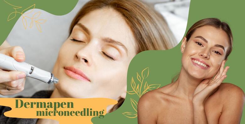 Smanjite bore i ožiljke uz DERMAPEN MICRONEEDLING TRETMAN <br>za osvježavanje izgleda