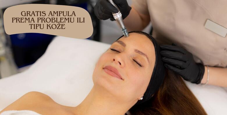 Microneedling uz njegu lica pilingom