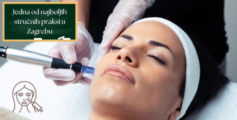 Tečaj Dermapen microneedlinga - naučite izvoditi popularan tretman estetske dermatologije i kako riješiti različite kožne probleme u organizaciji Ustanove Dominus