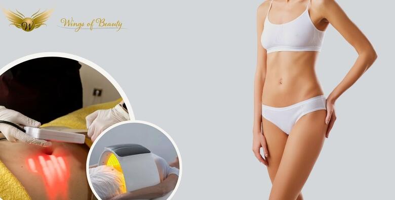 Oblikujte svoje tijelo uz 3 tretmana TERMODEKOM i 3 tretmana<br> SLIMM KUPOLE u kozmetičkom salonu Wings of Beauty