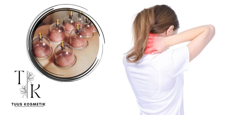 CUPPING MASAŽA - napravite detox ili tretirajte bolne mišiće