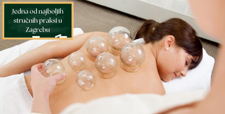 Edukacija cupping masaže - usvojite tehniku za ciljanu i preciznu primjenu cupping masaže u Ustanovi Dominus