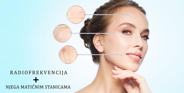 RADIOFREKVENCIJA + NJEGA MATIČNIM STANICAMA - čvrsta i zategnuta koža lica <br>u 90 minuta uz potpuno bezbolan tretman u Jean d`Arcel Medical & Beauty Institutu