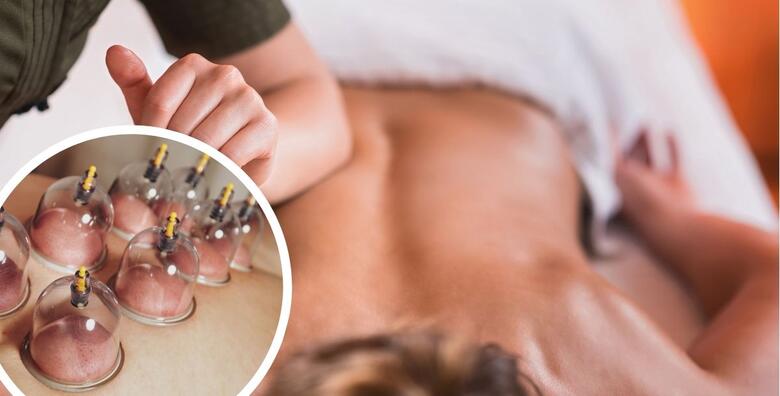 Sportsko-medicinska masaža cijelog tijela s  cupping terapijom u salonu Juran njega tijela
