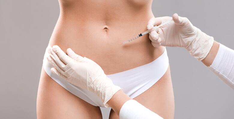 INJEKCIJSKA LIPOLIZA - uklonite potkožno masno tkivo <br>neinvazivnim oblikom terapije u Poliklinici Superiora