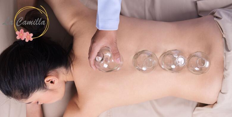 Iskusite moć medicinske masaže leđa i cupping terapije - prirodan put do olakšanja bola