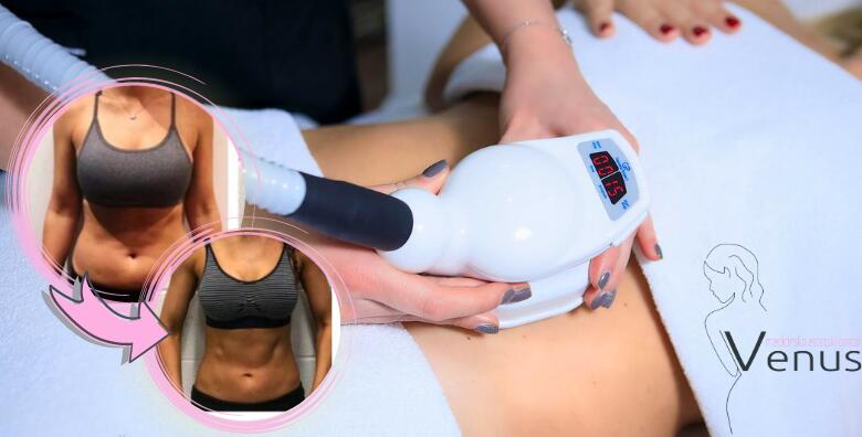 Smršavite uz NAJBOLJE APARATE NA TRŽIŠTU! Istopite masnoće uz Med2Contour