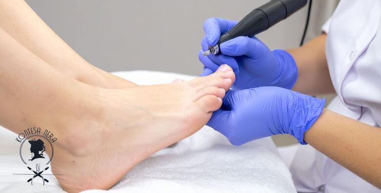 Zaslužena briga za vaša stopala - medicinska pedikura