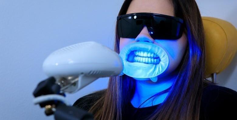 IZBJELJIVANJE ZUBI - ODMAH vidljivi rezultati bez oštećivanja cakline <br>uz inovativnu Smilite LED tehnologiju i Opalescence Boost gel