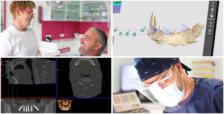 CBCT 3D snimka kompletne gornje i donje čeljusti uz detaljnu analizu snimke