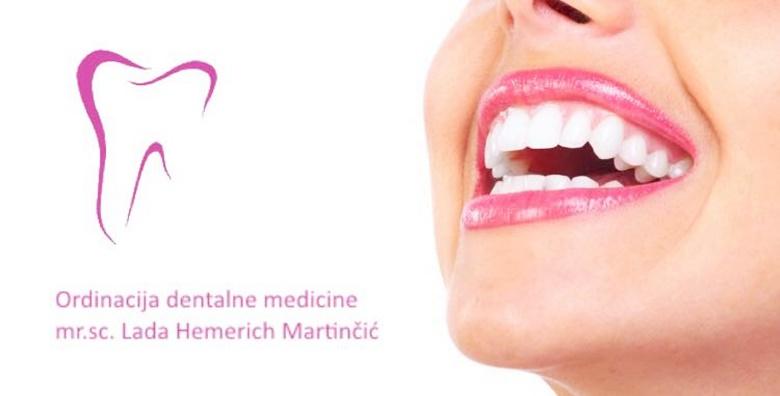 Ordinacija dentalne medicine Lada Hemerich Martinčić - pregled s konzultacijama