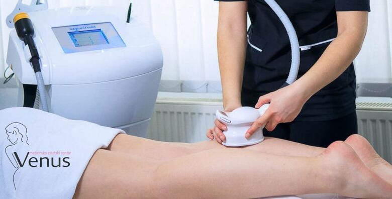 MED2CONTOUR u Medicinsko estetskom centru Venus